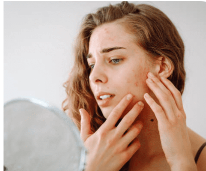 How to Treat Pigmentation Safely: Expert Skin Consultations & Products in Perth