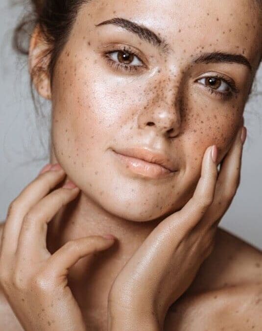 Struggling with Pigmentation? Discover Effective Removal Options in Perth