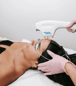 BBL Laser Treatments in Perth: Brighten, Clear & Rejuvenate Your Skin