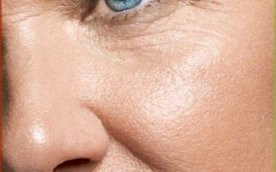 Forever Young: How The Skin Nurse Australia Uses BBL Hero & SkinTyte for Ageing Skin